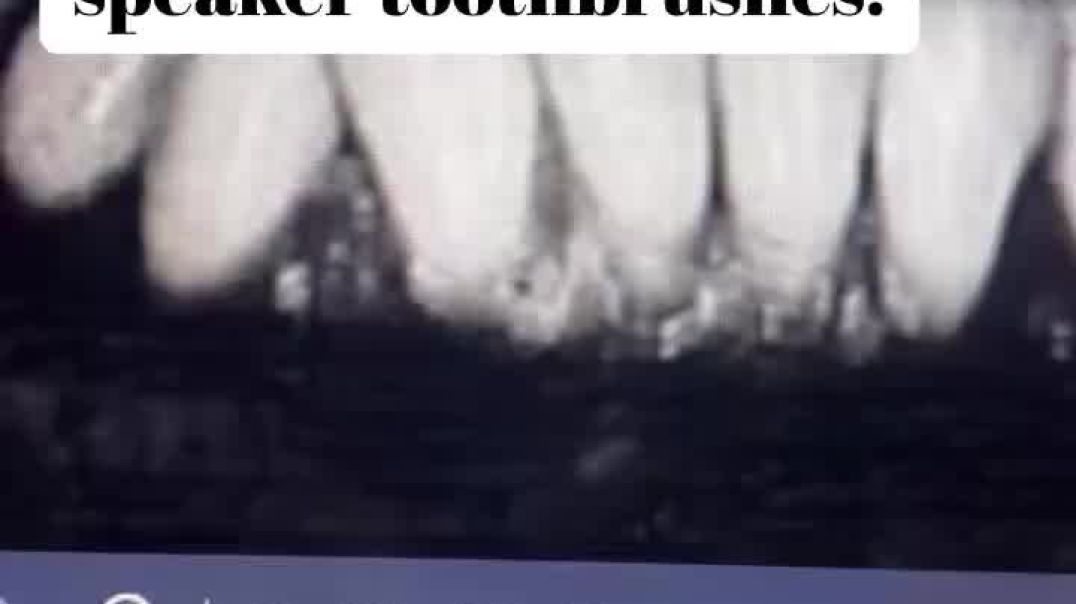 Heal and Strengthen your teeth with sound