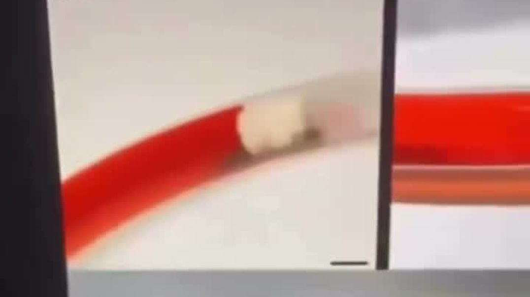 Theory Is This In You Vaccines And Food